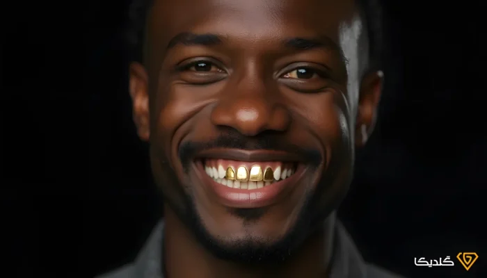 روکش دندان طلا چه مزایایی دارد؟