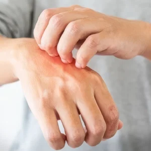 آکادمی گلدیکا: آموزش حوزه طلا و طلای آب شده 25 با علائم حساسیت به نقره آشنا شوید.